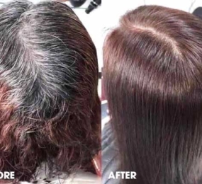 NHUỘM CHÂN TÓC BẠC